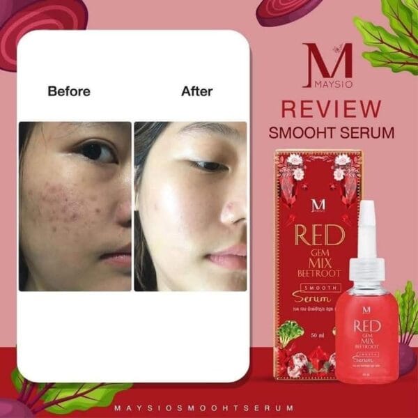 Maysio Red Gem Mix Beetroot Smooth Serum – 50ml প্রাকৃতিকভাবে ত্বক উজ্জ্বল ও মসৃণ করুন