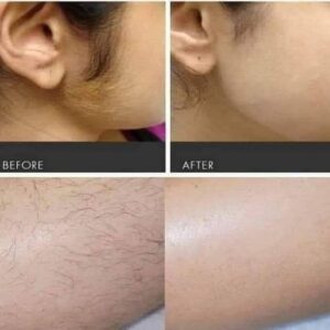 Episoft Hair Removal Serum (35ml) – অবাঞ্ছিত লোম দূর করার কার্যকর সমাধানEpisoft Hair Removal Serum (35ml) – অবাঞ্ছিত লোম দূর করার কার্যকর সমাধান