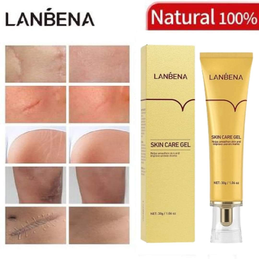 Lanbena TCM Scar and Acne Mark Removal Gel Ointment – 30gm | শক্তিশালী দাগ ও অ্যাকনে মার্ক দূর করার সমাধান Lanbena TCM Scar and Acne Mark Removal Gel Ointment – 30gm | শক্তিশালী দাগ ও অ্যাকনে মার্ক দূর করার সমাধান